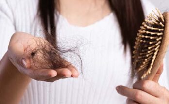 Hair Loss In The Winters
