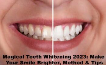 Magical Teeth Whitening