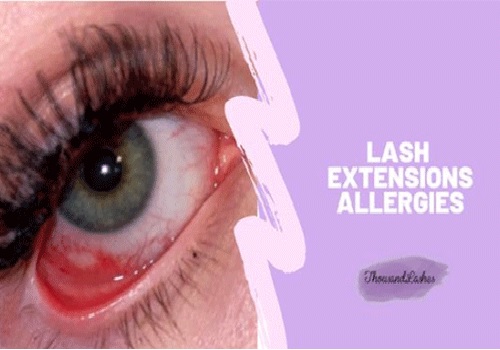 allergic to eyelash extensions
