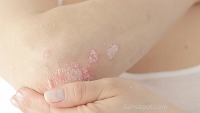 Dry skin Symptoms